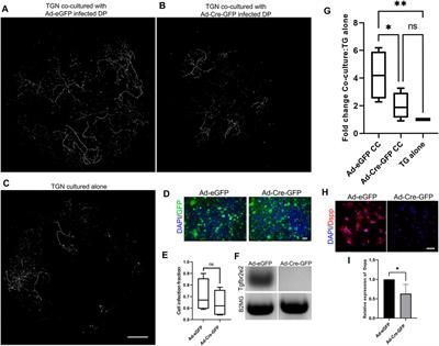 Tgfbr2 in Dental Pulp Cells Guides Neurite Outgrowth in Developing Teeth